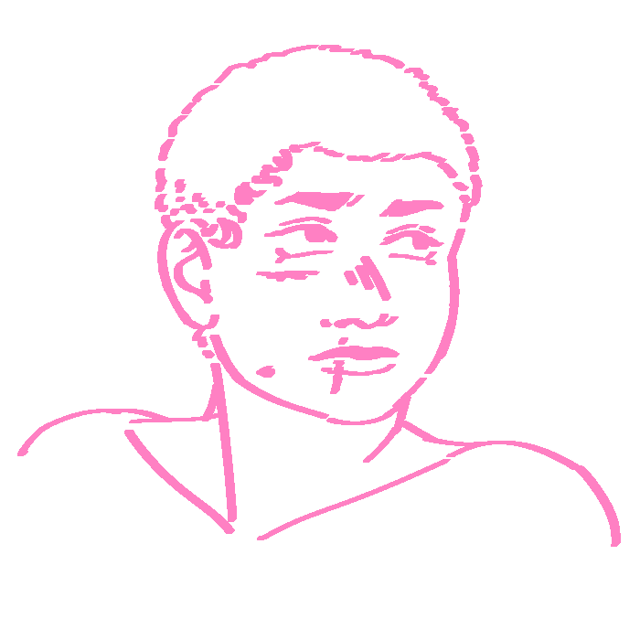 A digital line drawing of C78982943. She is a Black teenage girl with shaved hair and a scar under her eye, one vertically through her lip, and one on the right side of her jaw. She looks concerned off towards our right.